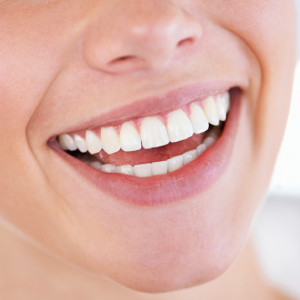 Best Pre-Treatment Tips for Teeth Whitening in Sacramento