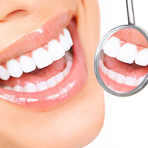 Teeth Whitening – After Care