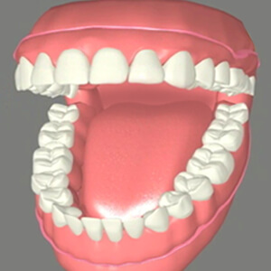 Dentures Sacramento California