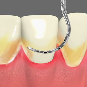 Periodontal Care Sacramento California