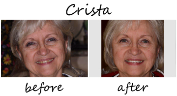 Crista 1